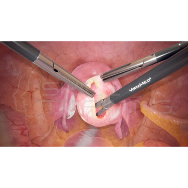 Virtamed Gynos™ Gynecological Laparoscopy Module (4) - Imagen 1