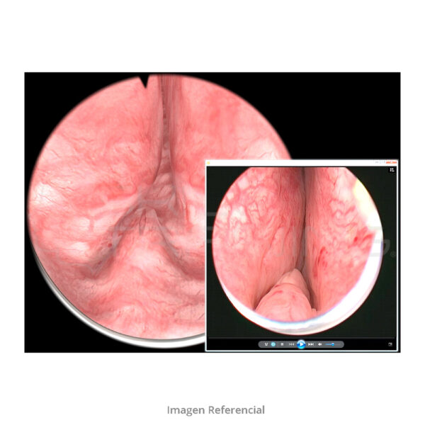 Virtamed Uros™ Urology Platform Extension - Imagen 1