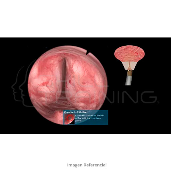Virtamed Uros™ Turp Module - Imagen 1