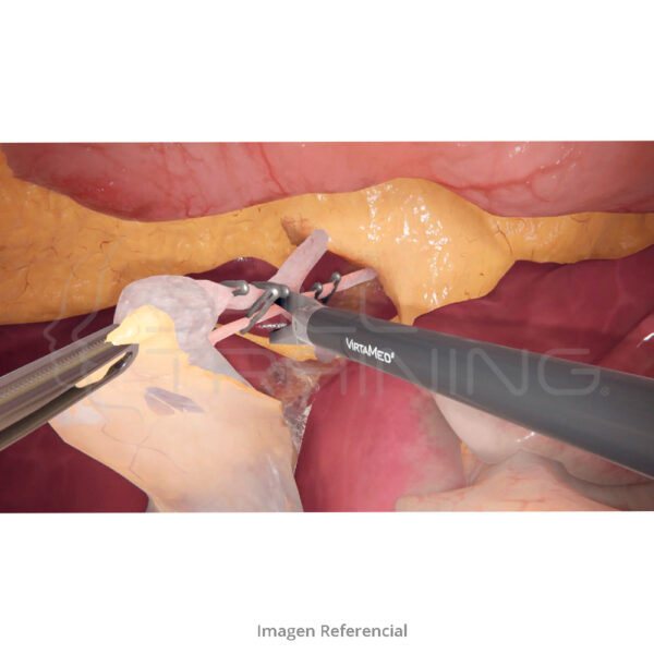 Virtamed Laparos™ Laparoscopy Platform Extension - Imagen 1