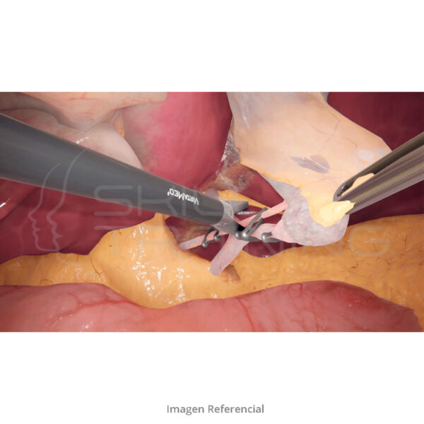 Virtamed Laparos™ General Surgery Module - Imagen 1