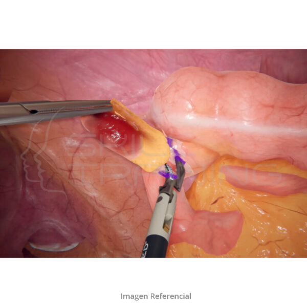 Virtamed Laparos™ Upper Gi Surgery Module - Imagen 1