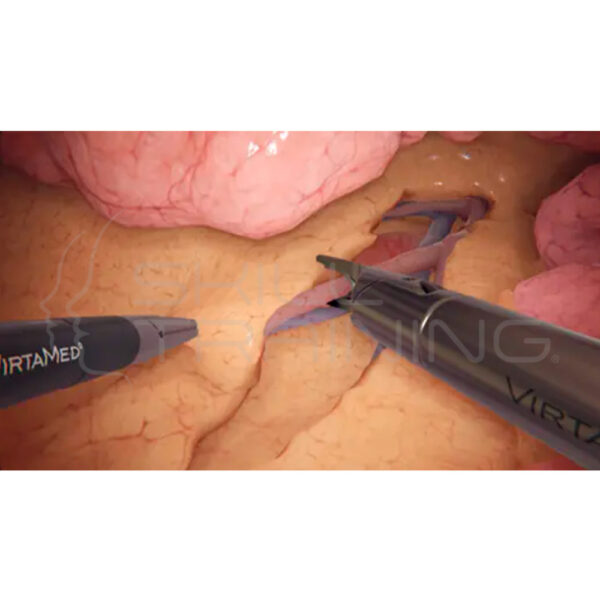 Virtamed Laparos™ Colorectal Surgery Module - Imagen 1