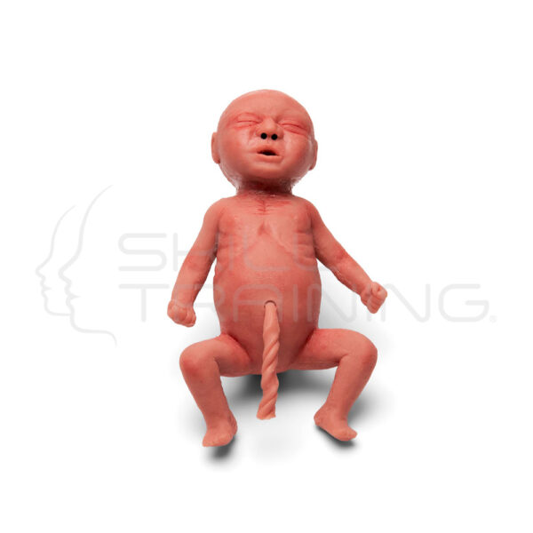 Premature (preterm) Newborn - Imagen 1