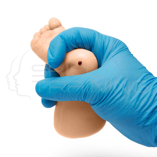 Newborn Screening Test (heel, Prick Test) - Imagen 1