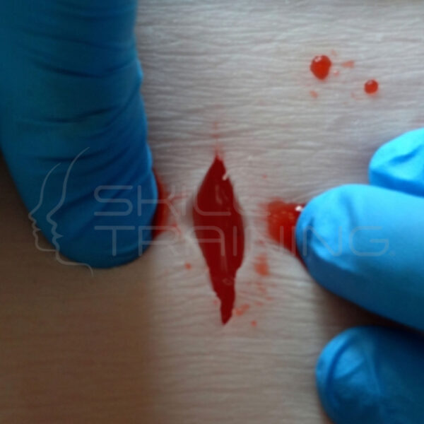 Almohadilla de Hemostasia Mini (hp Mini) - Imagen 1