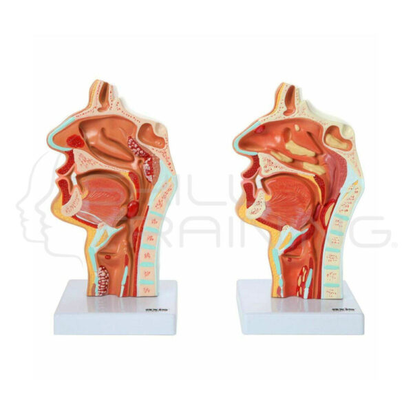 Laryngeal and Pharyngeal Disorders Model - Imagen 1