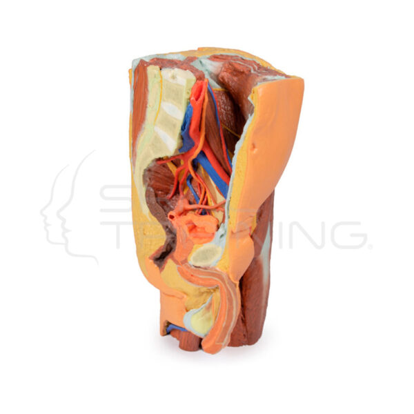 Pelvis Izquierda y Muslo Proximal Masculinos Impresos en 3d - Imagen 1