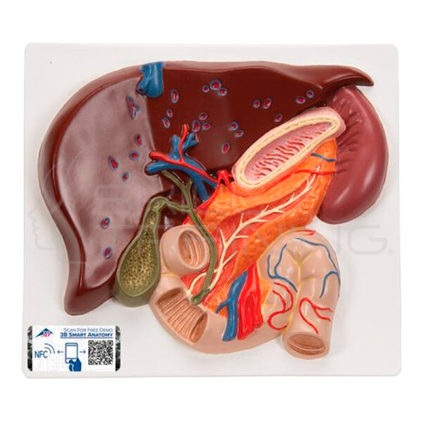 Modelo Anatomico del Higado Humano con Vesicula Biliar - Imagen 1