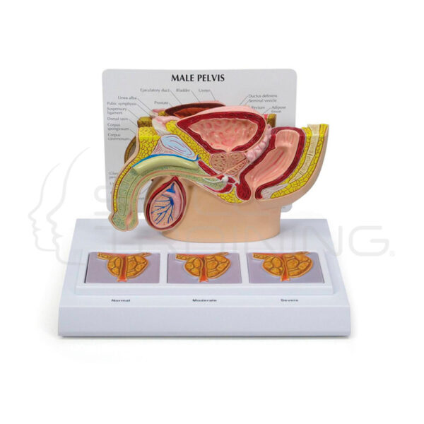 Modelo de Anatomia de Pelvis Masculina con Prostata - Imagen 1
