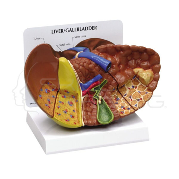 Higado con Patologias - Imagen 1