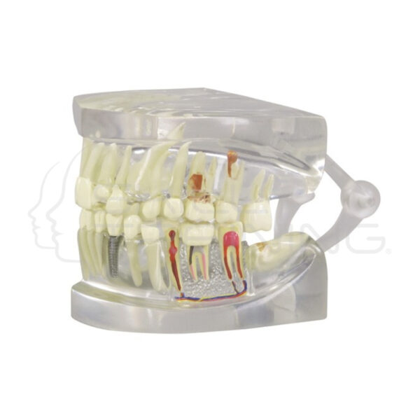Modelo Mandibula Humana Transparente con Dientes - Imagen 1