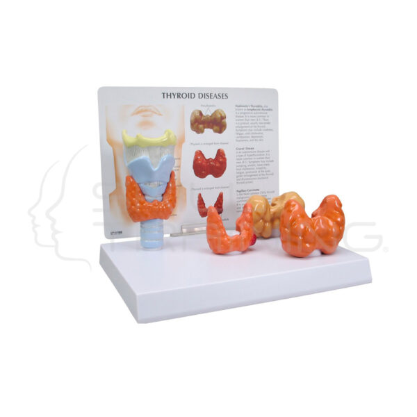 Modelo de Anatomia de la Enfermedad Tiroidea - Imagen 1