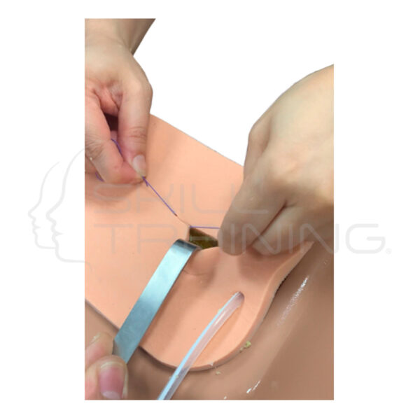 Simulador para Colocacion de Cateterperitoneal con Técnica Minimante Invasiva - Imagen 1