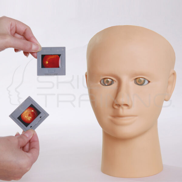 Entrenador de Retinopatía Ocular - Imagen 1