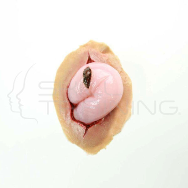 Evisceración Intestinal - Moulage - Imagen 1